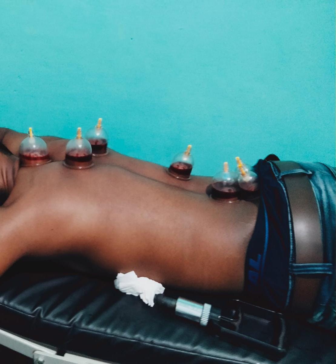 Smart Life Acupuncture & Hijama Research Center Kunnumpuram